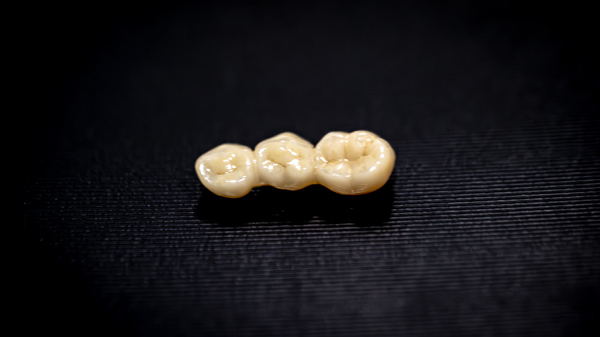 Types Of Dental Bridges And How To Choose The Right One For Your Smile