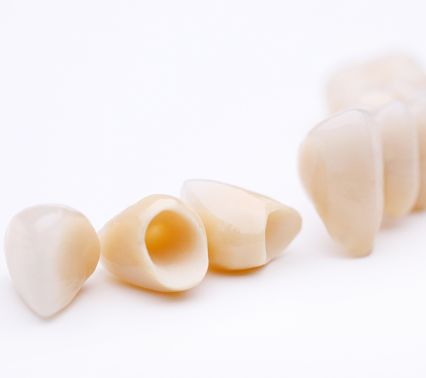 Patterson Dental Crowns and Dental Bridges