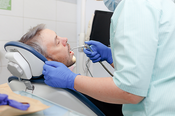 Reasons To Choose A Composite Filling Over A Silver Filling