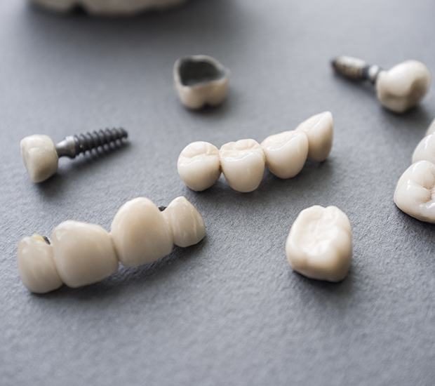 Patterson The Difference Between Dental Implants and Mini Dental Implants