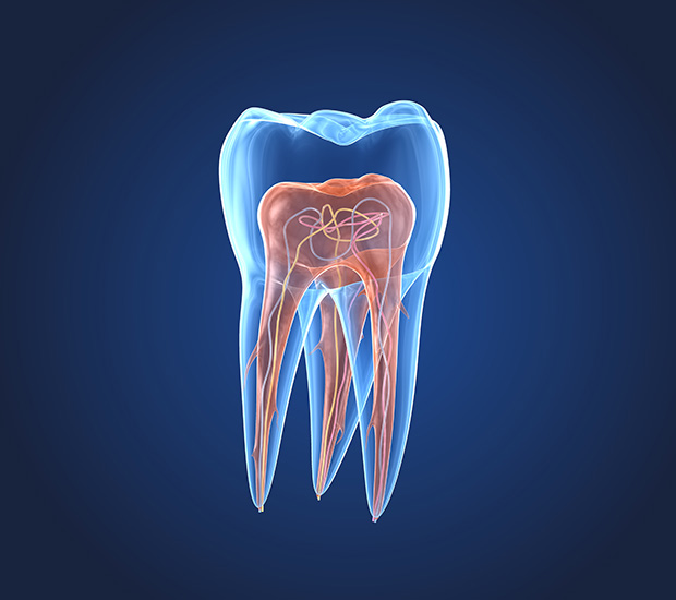 Patterson What is an Endodontist